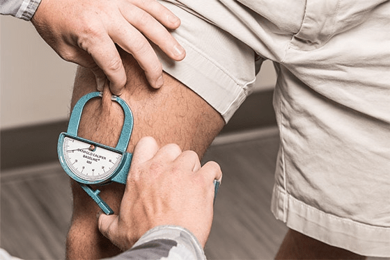 Thigh skinfold measurement