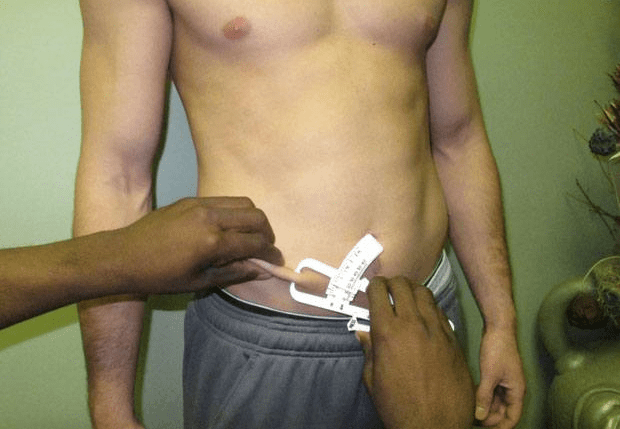 Suprailiac skinfold measurement